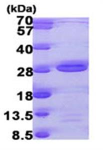 ab104633-500ug | Recombinant Human AK6 protein  