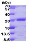 ab104633-500ug | Recombinant Human AK6 protein  