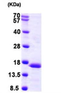 ab104644-250ug | Recombinant Human PFD6 protein  