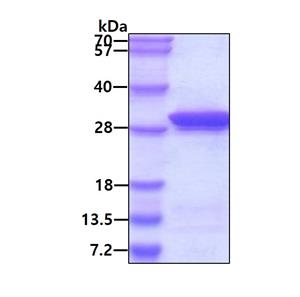 ab104671-100ug | Recombinant Human MESDC2 protein 