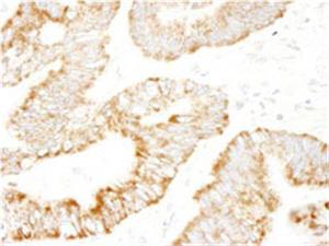 ab105110-100uL | Anti-RAPGEF2 antibody