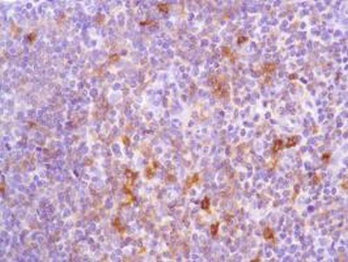 ab105227-1mL | Anti-ICOS antibody [SP98]