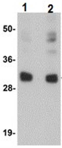 ab105354-100ug | Anti-CCDC106 antibody