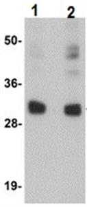 ab105354-100ug | Anti-CCDC106 antibody