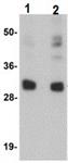 ab105354-100ug | Anti-CCDC106 antibody