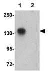 ab105377-100ug | Anti-ATP11B antibody