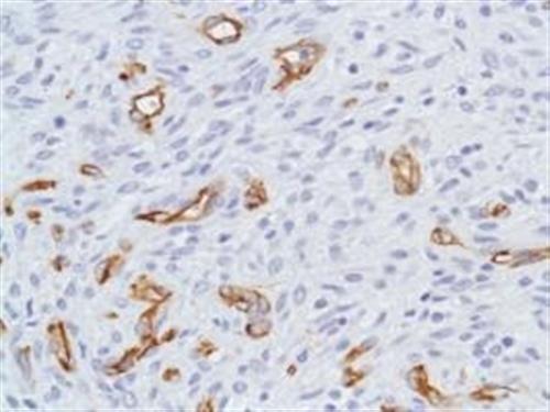 ab105389-1mL | Anti-Nestin antibody [SP103] - Neural