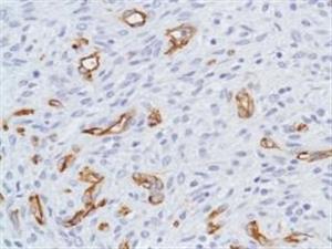 ab105389-20uL | Anti-Nestin antibody [SP103] - Neural