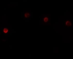 ab105395-100ug | Anti-PLAC1 antibody