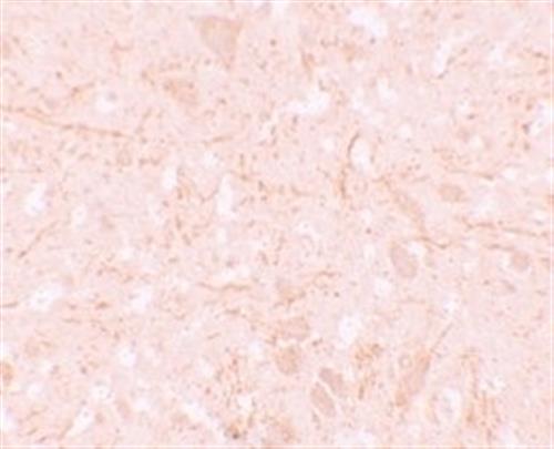 ab105409-100ug | Anti-NALP12/NLRP12 antibody