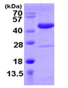 ab105599-250ug | Recombinant Human SPOP protein  