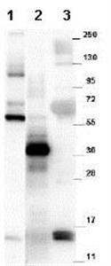 ab105738-100ug | Anti-GDF15 antibody Target GDF15