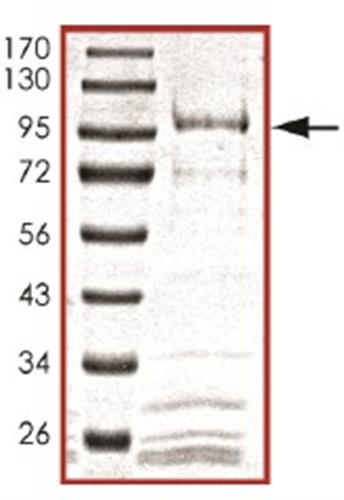 ab105906-10ug | Recombinant human Cdc25B protein Target