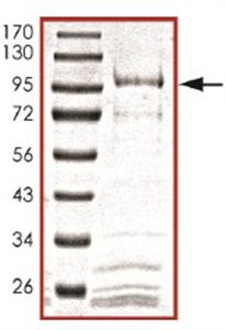 ab105906-10ug | Recombinant human Cdc25B protein Target