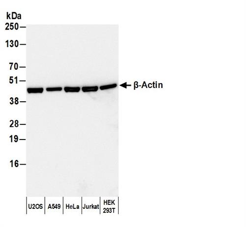 A120-101P | Goat anti-Rabbit IgG Heavy and Light Chn Antibody HRP Conj
