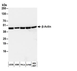 A120-101P | Goat anti-Rabbit IgG Heavy and Light Chn Antibody HRP Conj