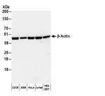 A120-101P | Goat anti-Rabbit IgG Heavy and Light Chn Antibody HRP Conj