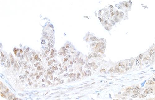 A300-081A | Rabbit anti-gamma-H2AX Antibody, Affinity Purified