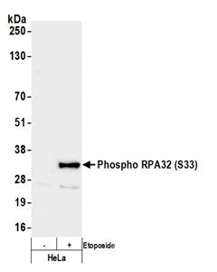 A300-246A | Rabbit anti-Phospho RPA32 (S33) Antibody, Affinity Purified