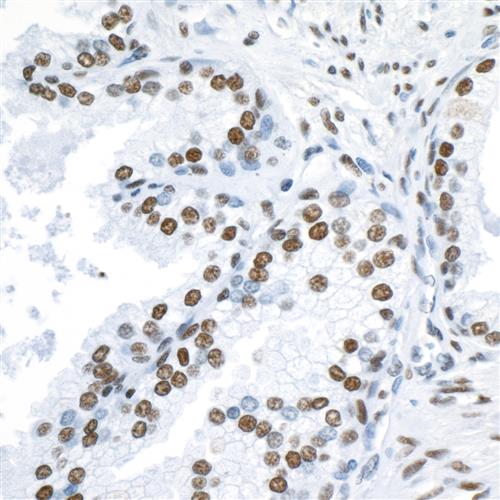 A300-272A | Rabbit anti-53BP1 Antibody, Affinity Purified