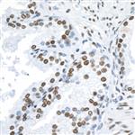 A300-272A | Rabbit anti-53BP1 Antibody, Affinity Purified