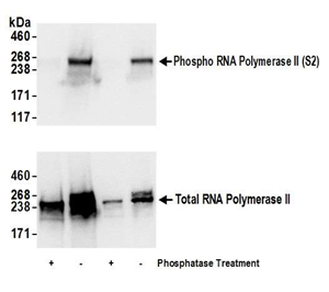 A300-654A | Rabbit anti-Phospho RNA Polymerase II (S2) Antibody, Affinity Purified