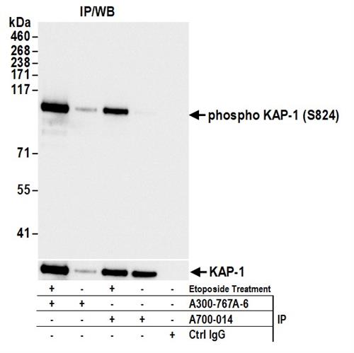 A300-767A | Rabbit anti-Phospho KAP-1 (S824) Antibody, Affinity Purified