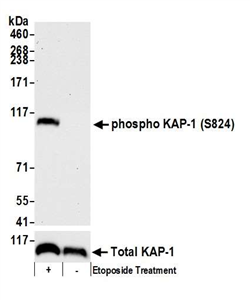 A300-767A | Rabbit anti-Phospho KAP-1 (S824) Antibody, Affinity Purified