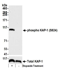 A300-767A | Rabbit anti-Phospho KAP-1 (S824) Antibody, Affinity Purified