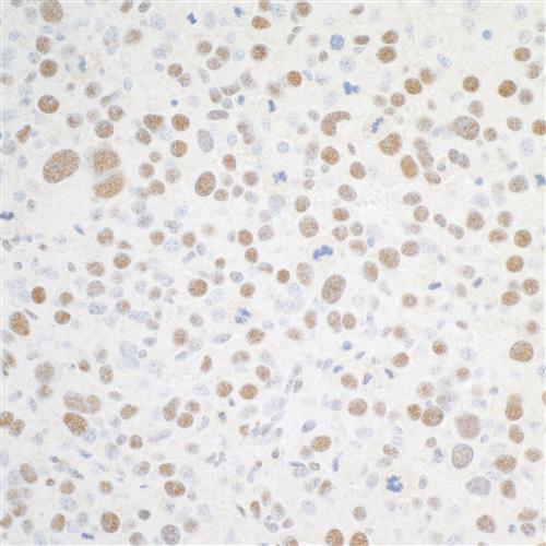 A301-985A100 | Rabbit anti-BRD4 Antibody, Affinity Purified