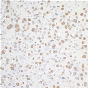 A301-985A100 | Rabbit anti-BRD4 Antibody, Affinity Purified