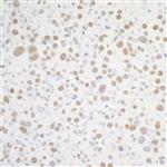 A301-985A100 | Rabbit anti-BRD4 Antibody, Affinity Purified
