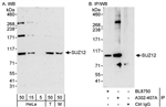 A302-407A | Rabbit anti-SUZ12 Antibody, Affinity Purified