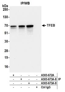 A303-673A | Rabbit anti-TFEB Antibody, Affinity Purified