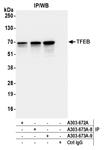 A303-673A | Rabbit anti-TFEB Antibody, Affinity Purified