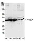 A304-735A | Rabbit anti-STRAP Antibody, Affinity Purified