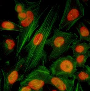 A700-004 | Rabbit anti-BRD4 Recombinant Monoclonal Antibody [BL-149-2H5]