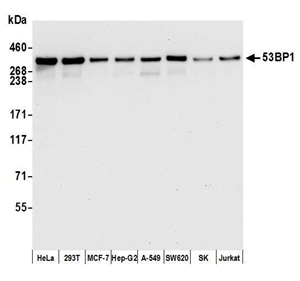 A700-011 | Rabbit anti-53BP1 Recombinant Monoclonal Antibody [BL-250-1H11]