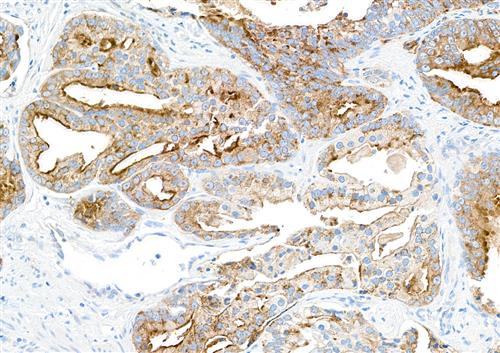 A700-092 | Rabbit anti-TJP1/ZO-1 Recombinant Monoclonal Antibody [BLR092G]