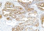 A700-092 | Rabbit anti-TJP1/ZO-1 Recombinant Monoclonal Antibody [BLR092G]