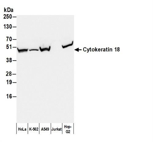 A90-105P | Goat anti-Mouse IgG1 Antibody HRP Conj