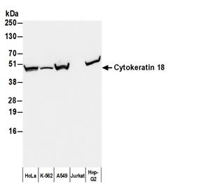 A90-105P | Goat anti-Mouse IgG1 Antibody HRP Conj