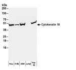 A90-105P | Goat anti-Mouse IgG1 Antibody HRP Conj