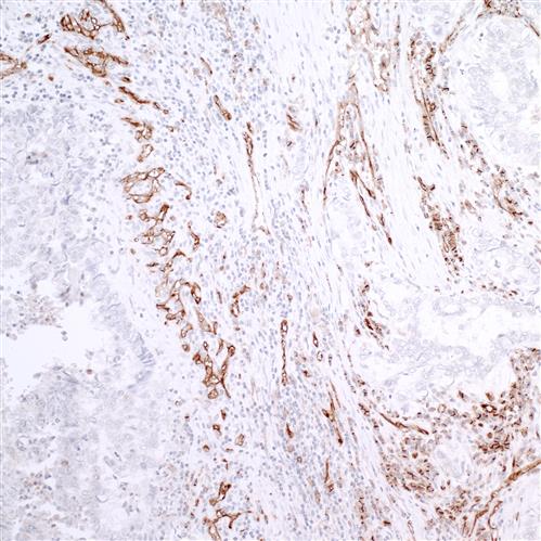 IHC-00055 | Rabbit anti-CD31/PECAM-1 IHC Antibody, Affinity Purified