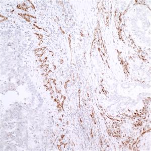 IHC-00055 | Rabbit anti-CD31/PECAM-1 IHC Antibody, Affinity Purified