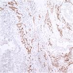 IHC-00055 | Rabbit anti-CD31/PECAM-1 IHC Antibody, Affinity Purified