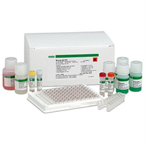 25182 | Mumps IgG EIA Test Kit
