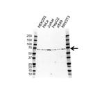 4260400-1 | PHD LX Silver Service