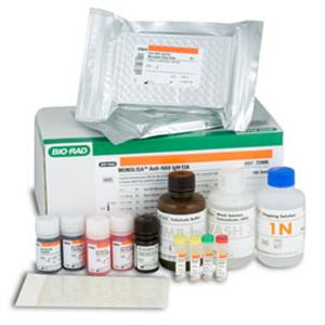 72495 | Monolisa Anti HAV IgM EIA 192 tests