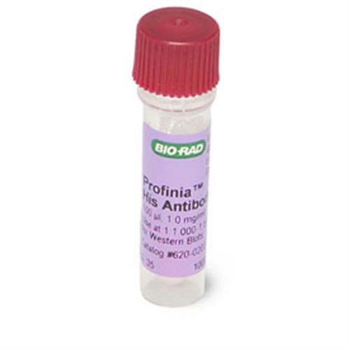 6200203 | His Antibody